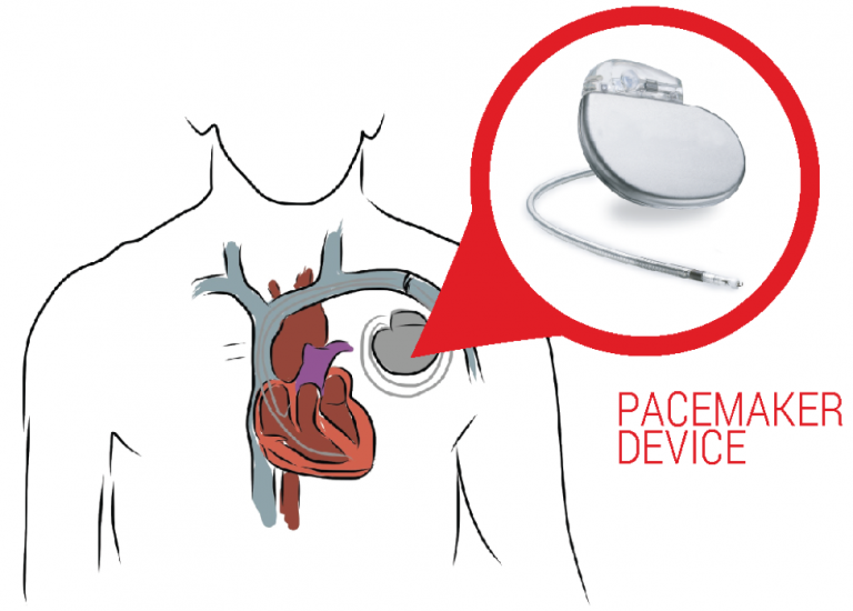 Patient Education Birmingham Heart Clinic